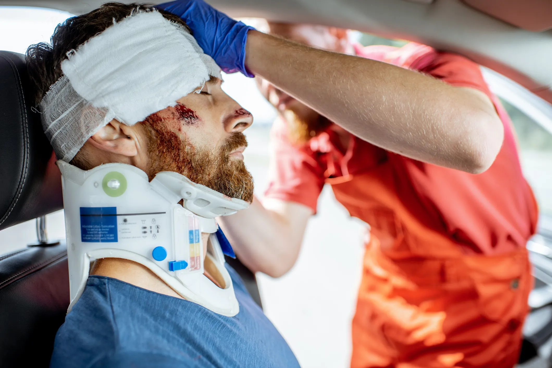 A man who experienced a traumatic brain injury in a car accdent.