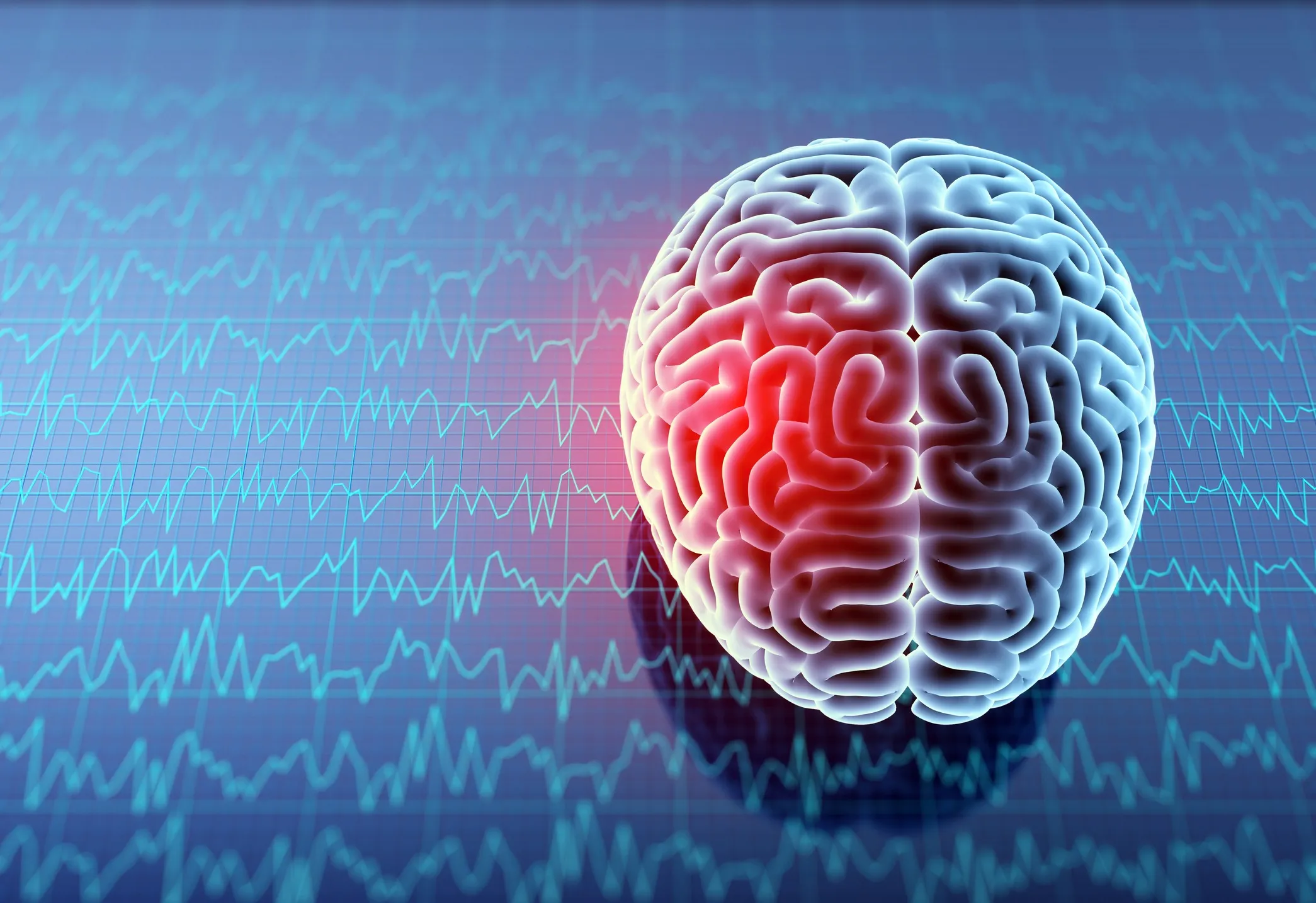 A designed image of a brain with a red spot to signify injury.